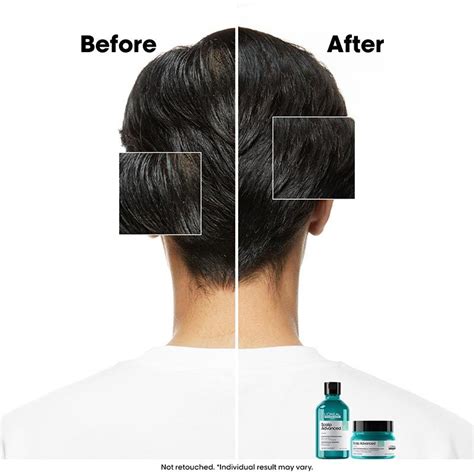 Buy L'Oreal Professionnel Scalp Advanced Anti-Oiliness Dermo-Purifier ...