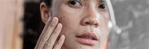 Frustrated that hyperpigmentation products aren’t working? We got you!
