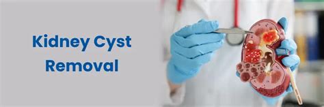 Best Surgery for Kidney Cysts: Laparoscopic, Open, Aspiration
