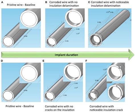 Chronically Implanted Intracranial Electrodes: Tissue Reaction and ...