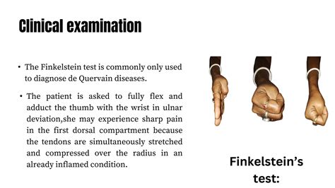 Dequervain's tenosynovitis splint case presentation | PPTX