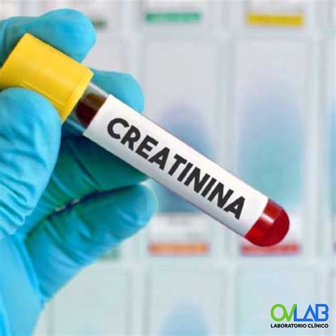 CREATININA – OVLAB – O&V Laboratorios
