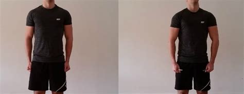 How To Improve Your Posture | Exercises & Stretches