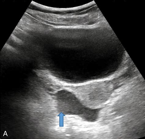 Emergent Ultrasound Procedures - Clinical Tree