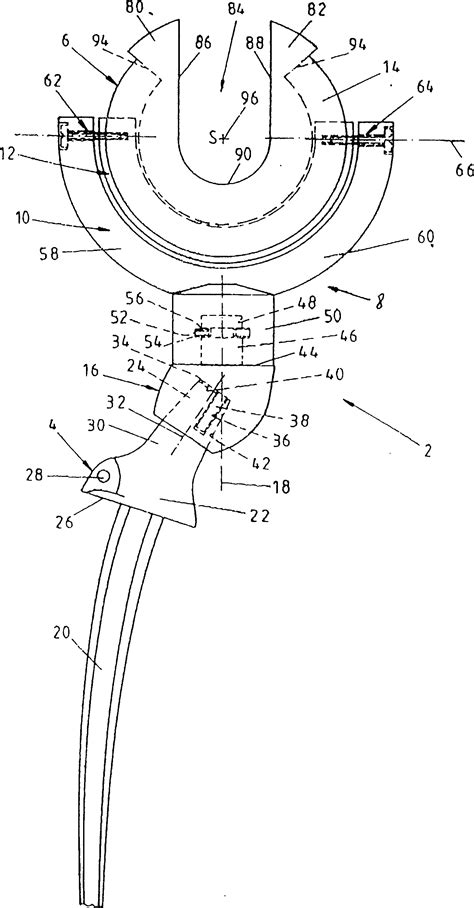 Saddle-type hip prosthesis - Eureka | Patsnap develop intelligence library