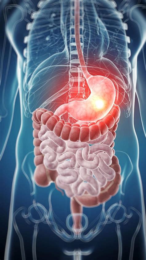 Painkiller side effects: रिकाम्या पोटी पेन किलर घेणे आरोग्यासाठी किती ...