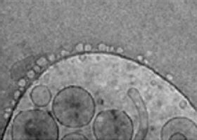 Image result for Autoscript Tem