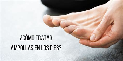 ¿Cómo curar ampollas en los pies? | FARMACÉUTICO ONLINE