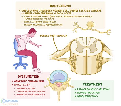 Dorsal Root Ganglion Anatomy _ Dorsal root ganglion – YDSVFU