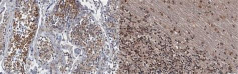 抗ERK1/2抗体、クローン16A6.1 clone 16A6.1, from mouse | Sigma-Aldrich