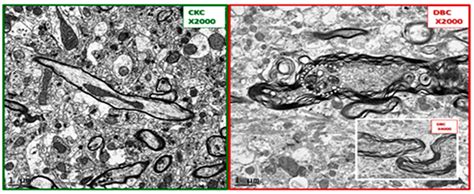 Ultrastructural Remodeling of the Neurovascular Unit in the Female ...
