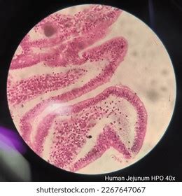 Image result for Jejunum Microscope