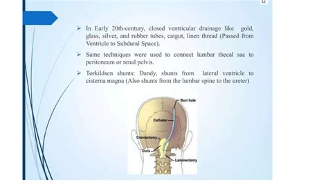 CSF diversion procedure VP shunt surgery.pptx