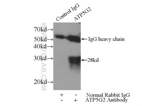 ATP5G2-Specific antibody (19785-1-AP) | Proteintech