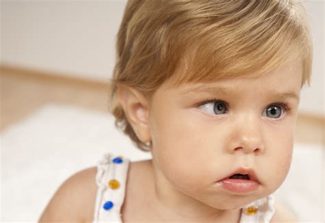 Strabismus Explained: What You Need to Know About Crossed Eyes | University of Utah Health