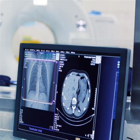 Soft Tissue Sarcoma | NYU Langone Health
