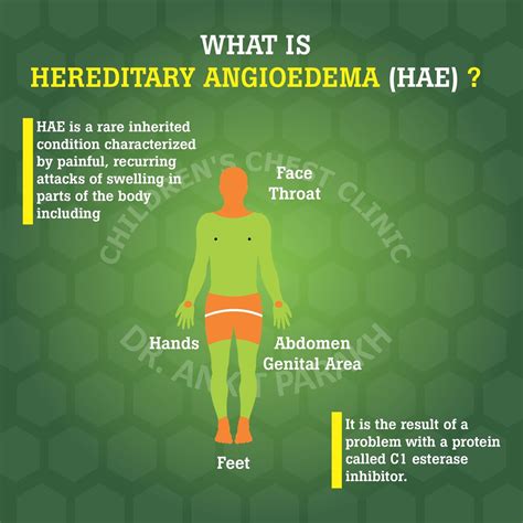 Hereditary Angioedema Quotes Hereditary Angioedema (HAE) Mnemonic