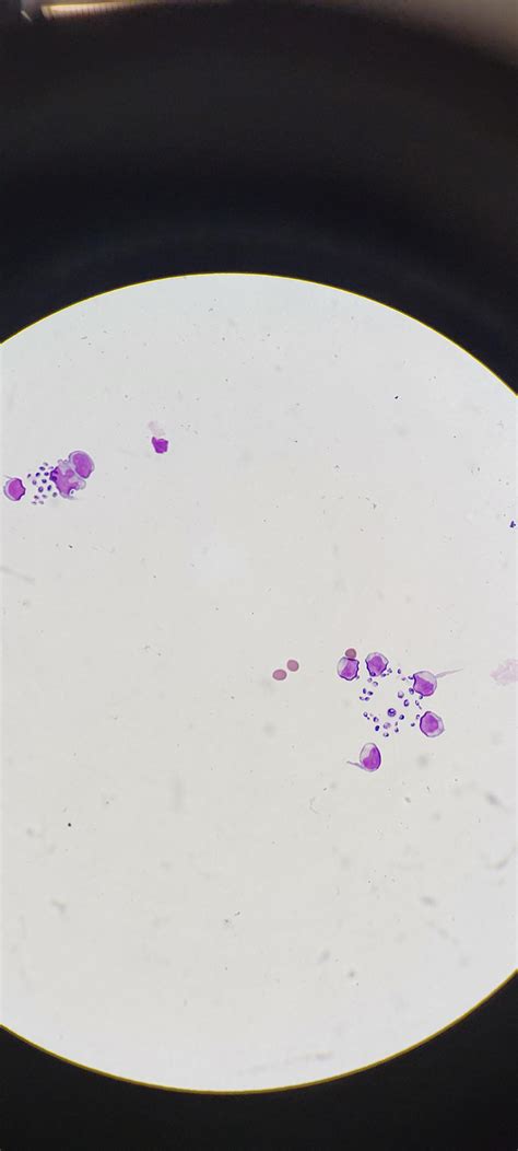 Image result for CSF Sample