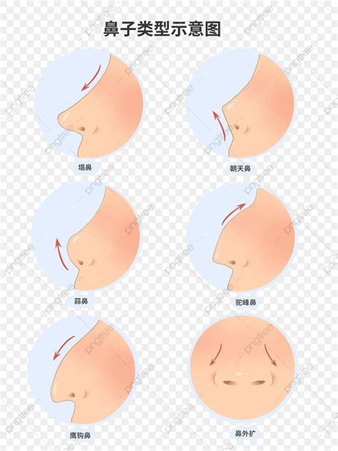 Types Of Noses Chart
