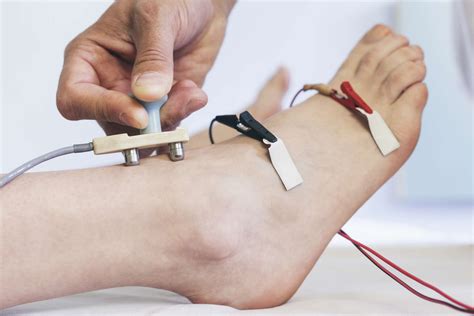 What Is A Nerve Test Emg at Carl Eason blog