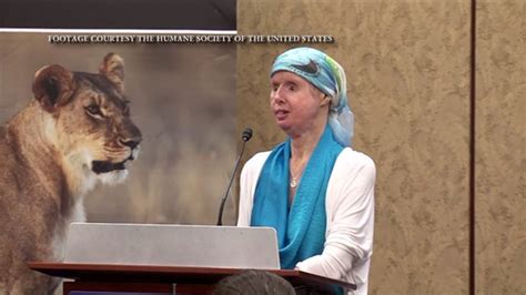 Chimp attack victim Charla Nash’s body ‘moderately rejecting’ face transplant | fox61.com