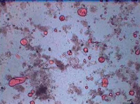 QDx Pathology GI Solutions: Expertise in Gastroenterology