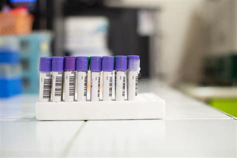 CBC Lab Panel 的图像结果