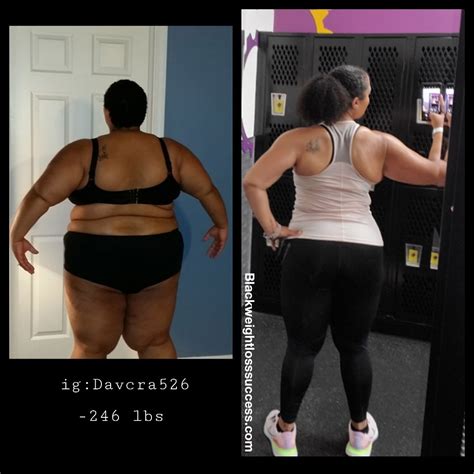 DaVina lost 246 pounds - Black Weight Loss Success