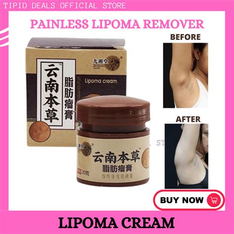 Original Lipoma Removal Cream Made in Japan | Herbal Treatment for Tumors and Swelling ...