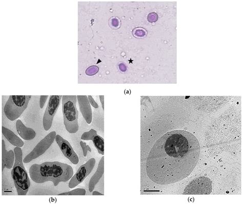 Shape-Shifted Red Blood Cells: A Novel Red Blood Cell Stage?