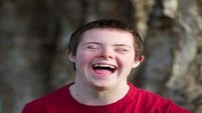 Down's syndrome: Ayurveda can effectively prevent and treat this ...