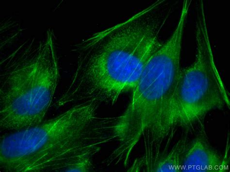 Calponin antibody (CL488-13938) | Proteintech