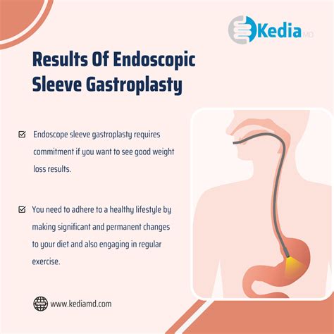 Endoscopic Sleeve Gastroplasty Treatment in Plano TX