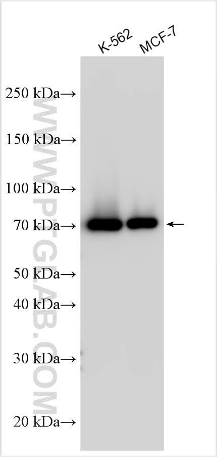 RIPK1 antibody (29932-1-AP) | Proteintech