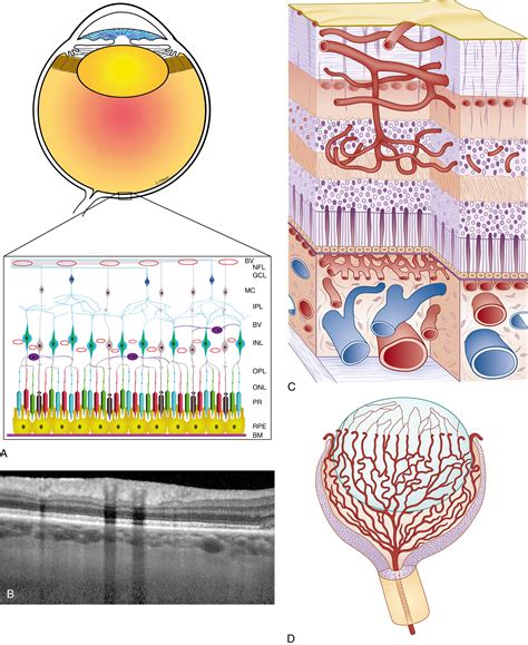 Pathophysiology of Retinopathy of Prematurity - Clinical Tree