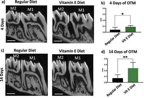 Vitamin E enriched diet increases the rate of orthodontic tooth movement - American Journal of ...
