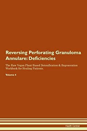 Buy Reversing Perforating Granuloma Annulare: Deficiencies The Raw ...