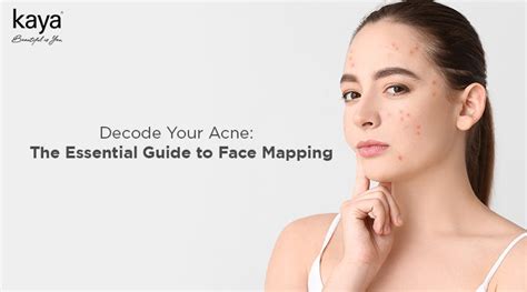 What Is Acne Face Mapping & How to Decode Acne Causes? - Blog