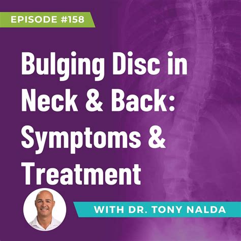 Episode 158: Bulging Disc in Neck & Back Symptoms & Treatment
