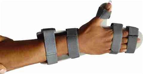 Helrdx Orthotics Wrist Hand Orthosis Full Cockup Stroke & Paralysis ...