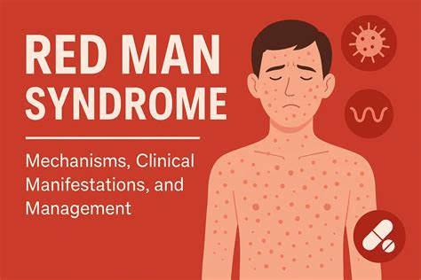 Red Man Syndrome: Mechanisms, Clinical Manifestations, and Management