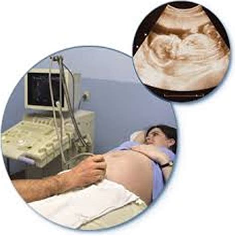 About of Ultrasound Scan - App on Amazon Appstore