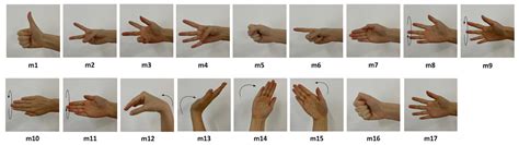 Improving Motion Intention Recognition for Trans-Radial Amputees Based ...
