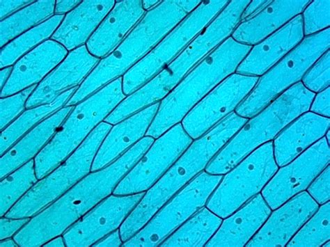 Plant Cells Under A Microscope Labeled