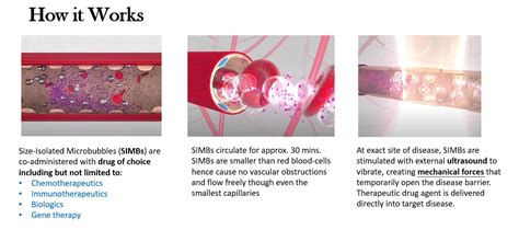 Image result for Definity Microbubbles