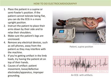 ecg 3.pptx