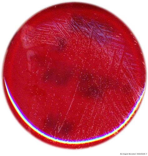 Bacteriemia por Mycoplasma hominis: un agente etiológico subestimado ...