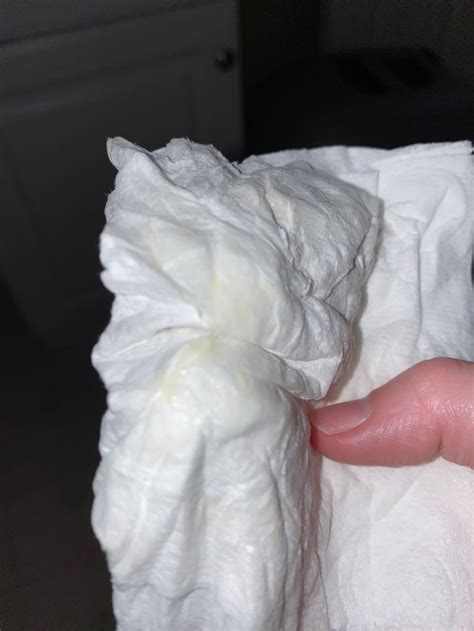 Yellowish Green Discharge