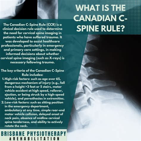 What is the Canadian C-Spine Rule? - Brisbane Physiotherapy & Podiatry