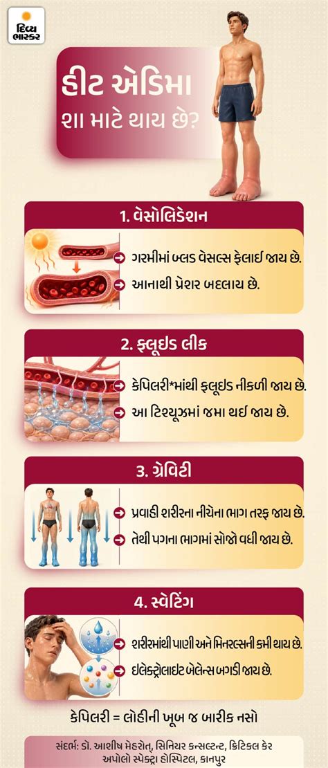 Heat Edema Symptoms: Summer Swelling Cases Rise; Know Risks & Precautions